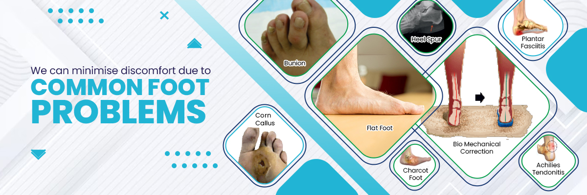 Common Foot Problems